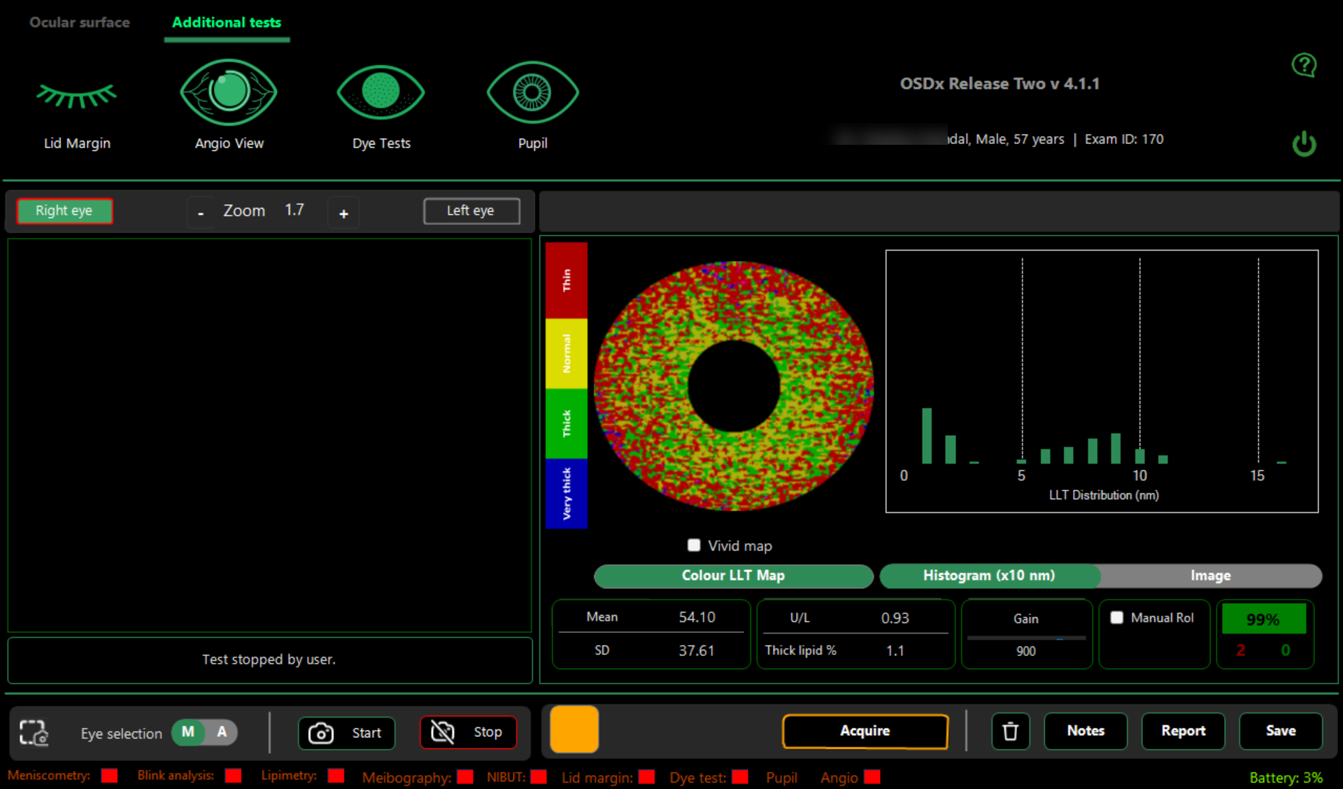 Lipimetry histogram view