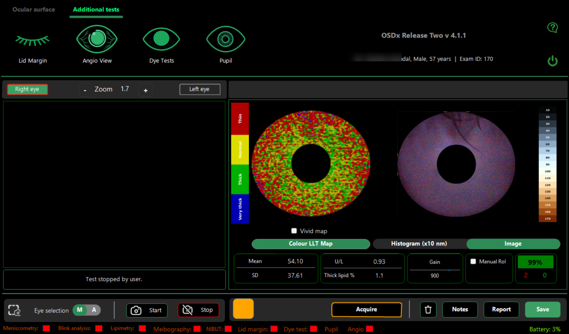 Lipimetry image view